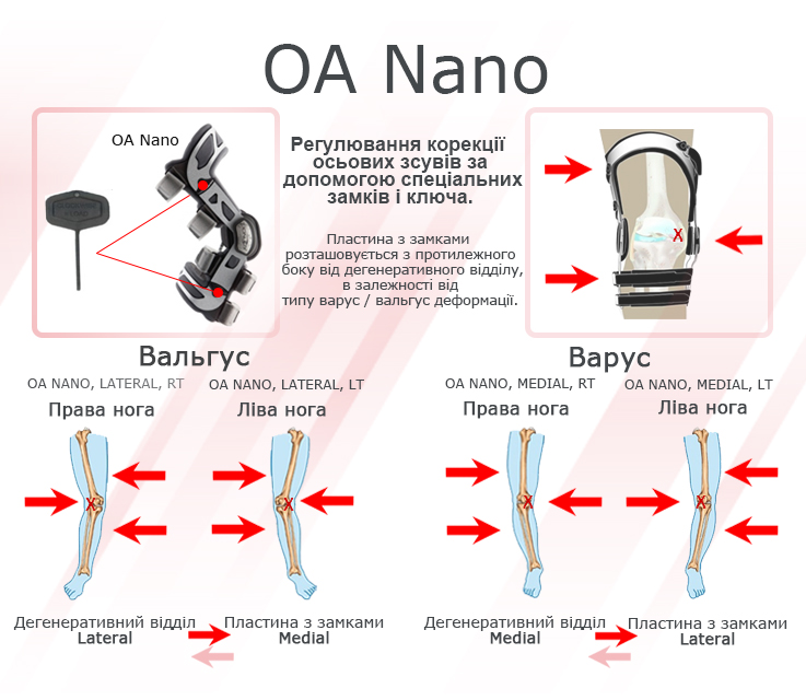 Ортез на колено OA NANO арт. 11-1215/11-1217 DONJOY, изображение - 4